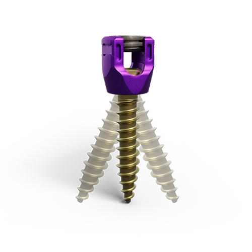 Zenex Pedicle Screw Multi-Axial Angulation