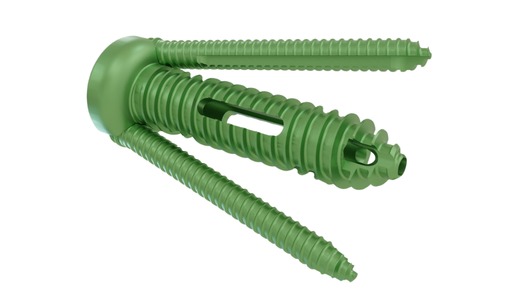 Sacronova implant